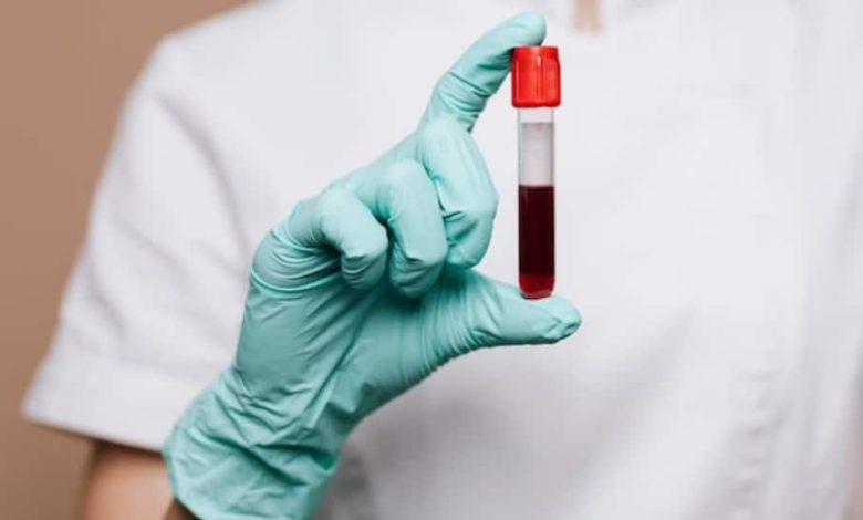 des-tests-sanguins-pourraient-aider-a-detecter-un-long-covid-chez-les-patients,-suggere-une-recherche